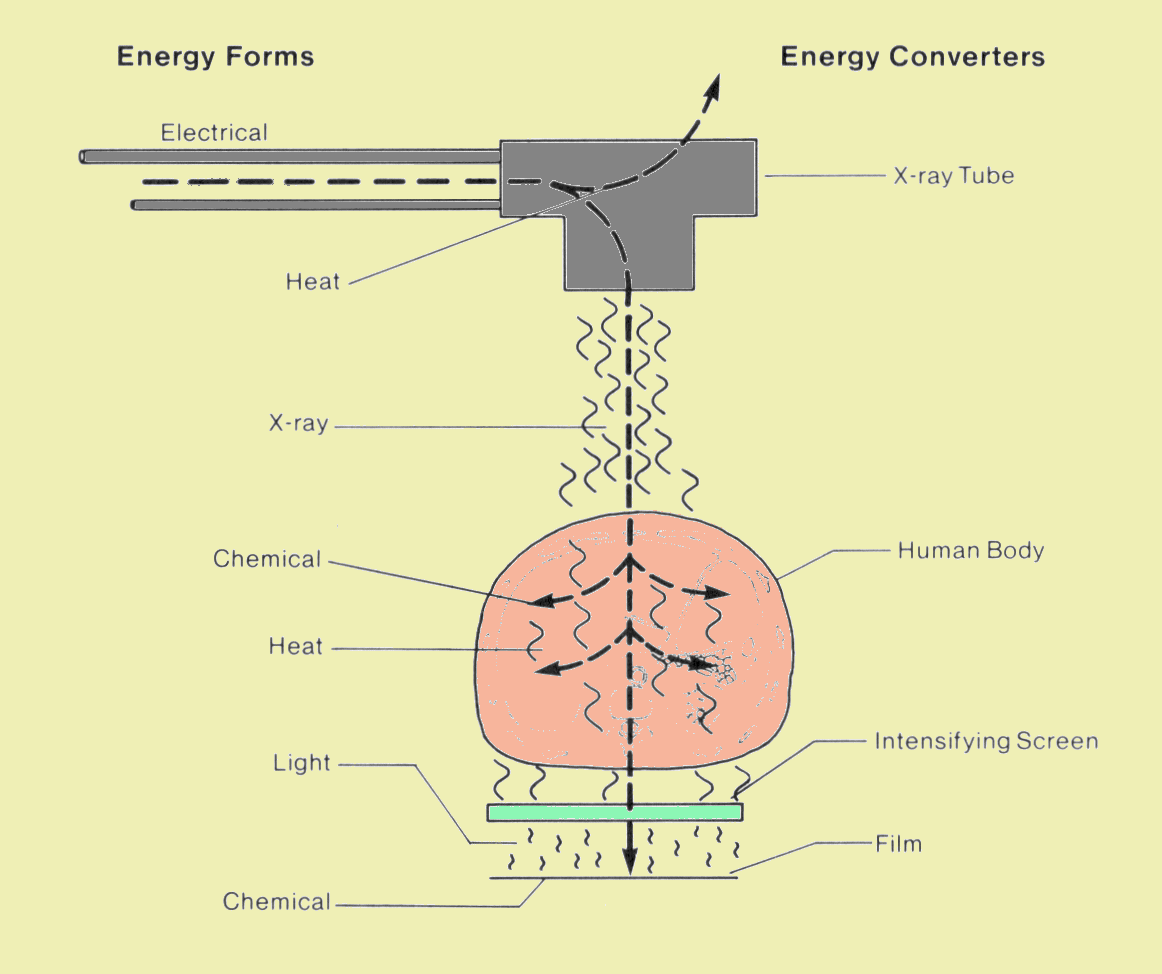 Forms of Energy Involved in the Production of an X-Ray Image