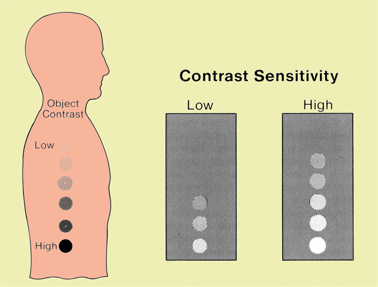 Increasing Contrast Sensitivity Increases Image Contrast and the Visibility of Objects in the Body