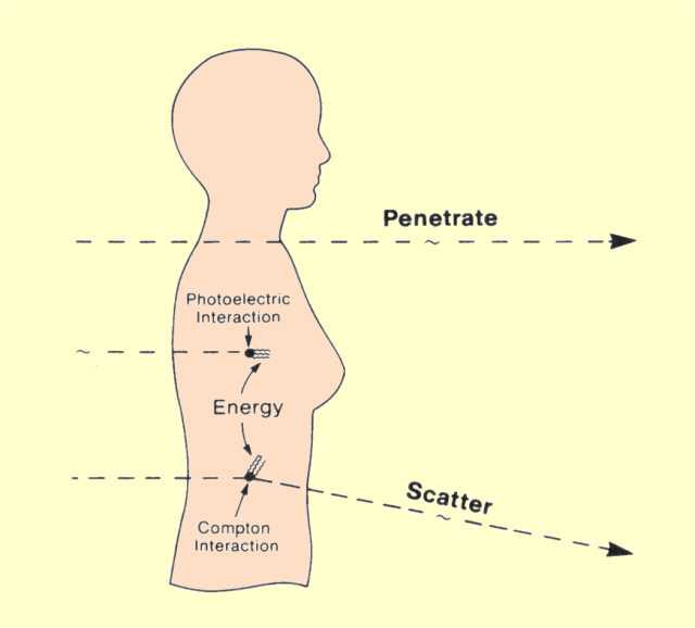 Photons Entering the Human Body Will Either Penetrate, Be Absorbed, or Produce Scattered Radiation