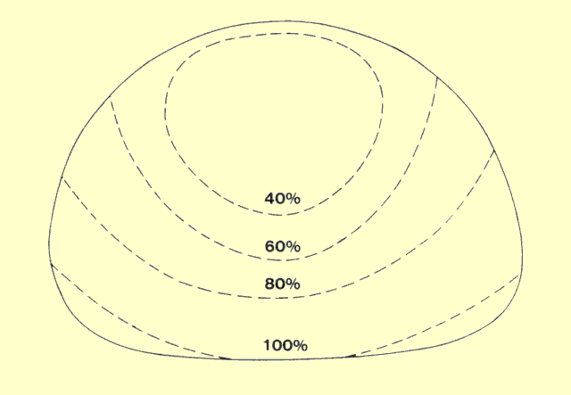 Typical Exposure (Dose) Pattern Produced with Computed Tomography