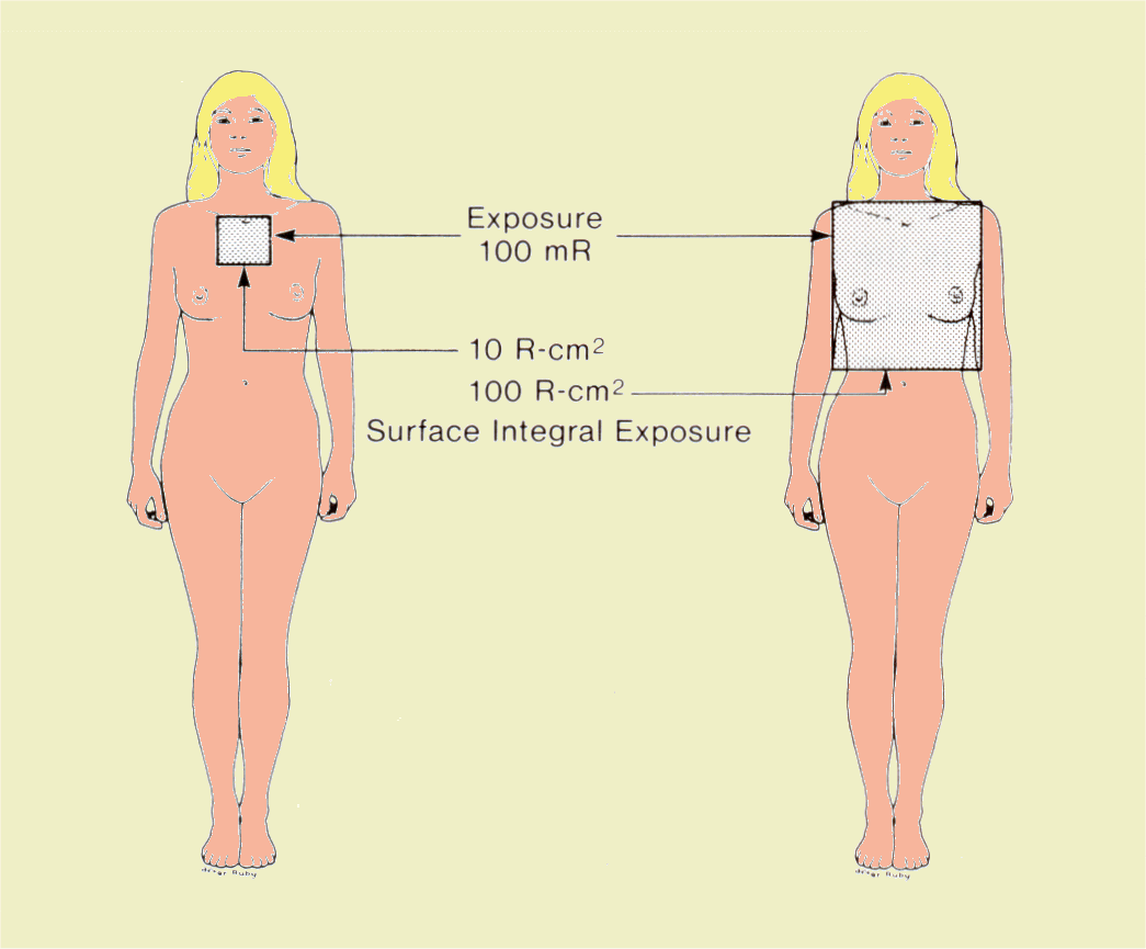 Comparison of SIE Values for a Radiographic Examination