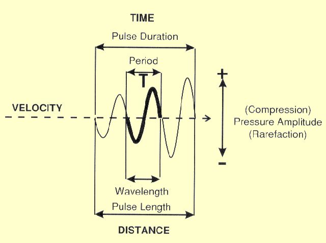 The Temporal and Length Characteristics of an Ultrasound Pulse