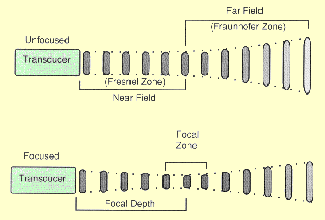 Beam Width and Pulse Diameter Characteristics of Both Unfocused and Focused Transducers