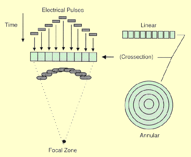 The Principle of Electronic Focusing with an Array Transducer