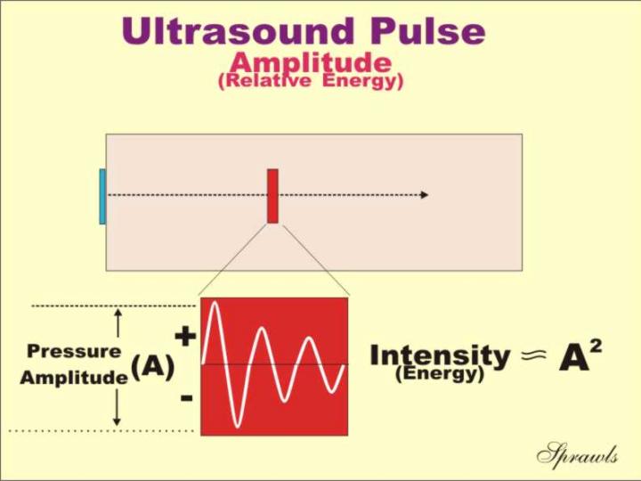 Ultrasound Intensity Chart