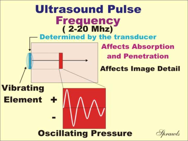 Ultrasound Frequency Chart