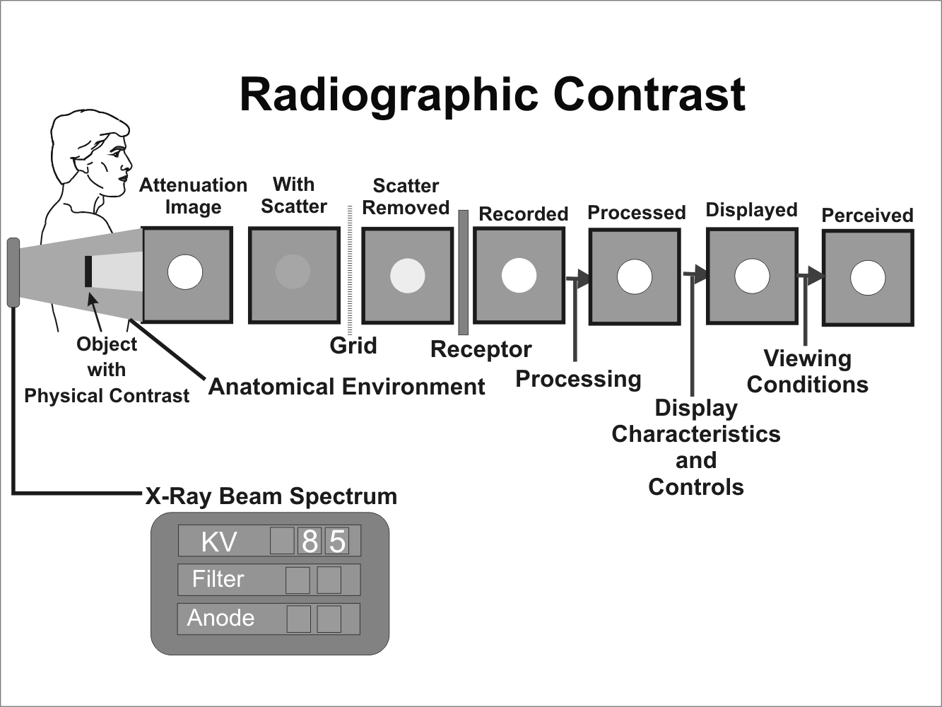 Radiographic Exposure Factors Chart