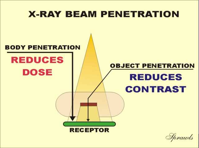 Discussion penetration vs exposure in radiology Thought penetration vs exposure in radiology
