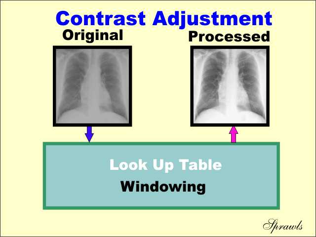 Digital Image Processing