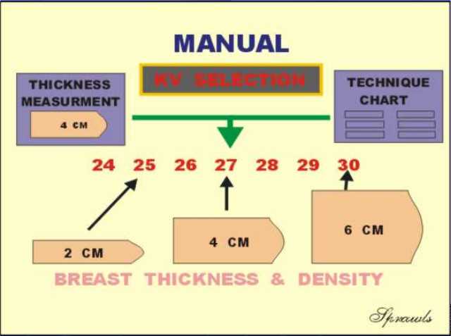 Mammography Exposure Chart